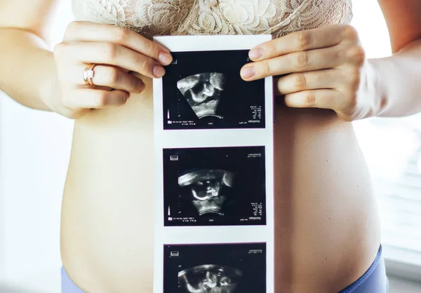 Donna incinta mostra con ultrasuoni bambino vicino alla finestra a casa — Foto Stock
