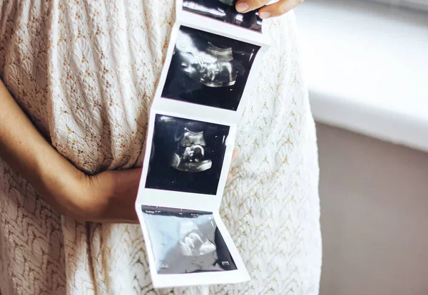 妊娠中の女性の手で超音波 — ストック写真
