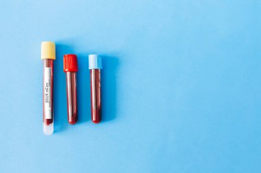 Koronavirüslü üç şişe.