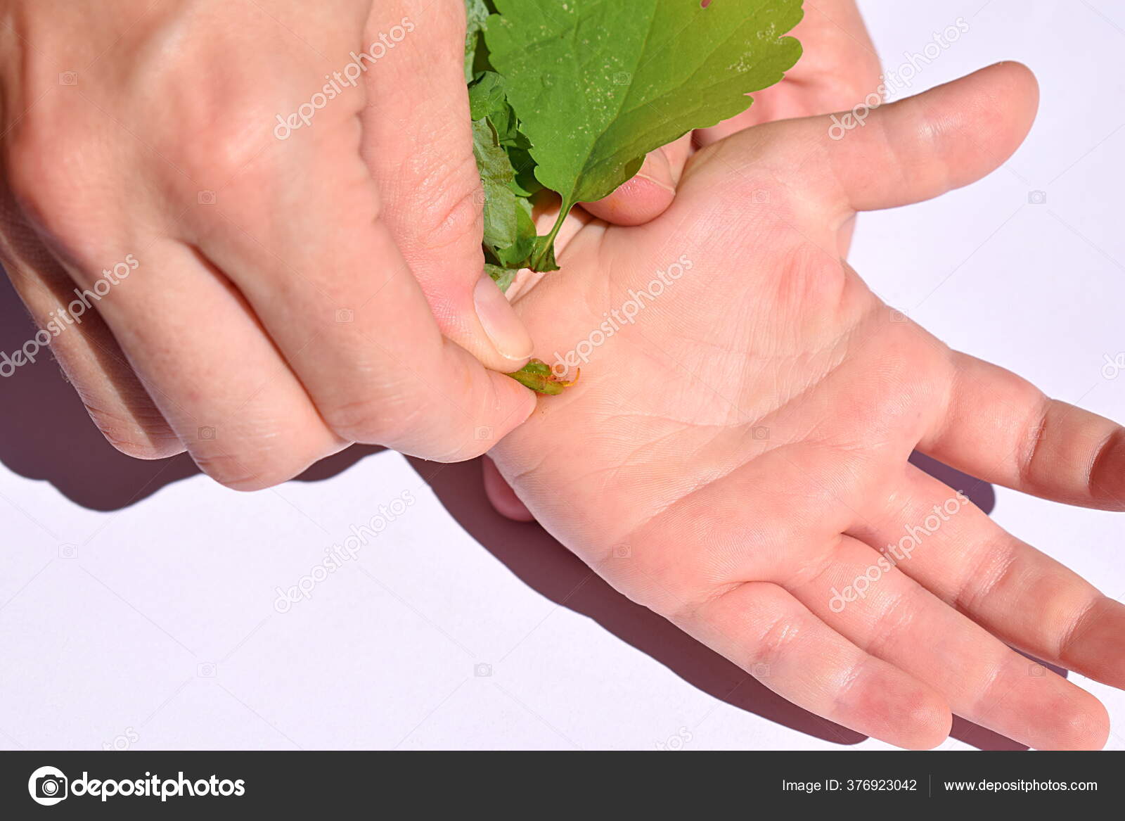 Бародавки на руках у ребёнка. Аллергические заболевания на руках. Детская инфекция реанимация. Контрактура де кервена. Детский массаж рук.