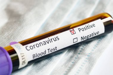 Kan örneğinde COVID-19 veya yeni Coronavirus SARS-CoV-2 pozitif..