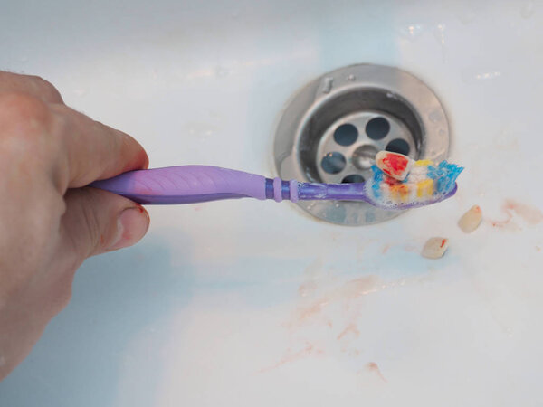 Tooth with a bloody brush in the washbasin. Dentistry concept