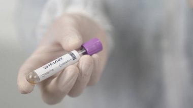 Bir doktor laboratuvarda koronavirüs için kan tüpü test ediyor. Coronavirus test tüpü.