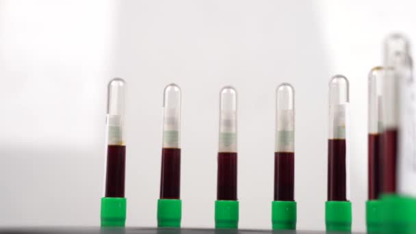 Coronavirus test tubes, flasks in laboratory. Coronavirus positive and negative test results. — Stock Video