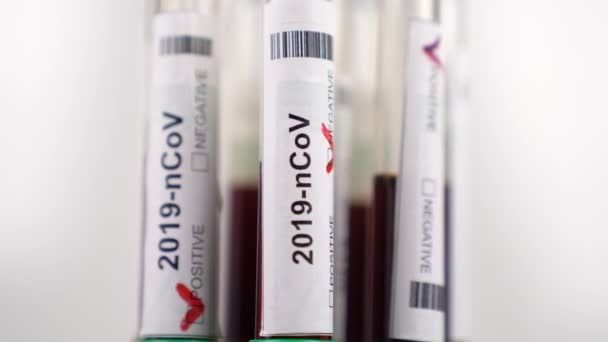 Coronavirus test tubes, flasks in laboratory. Coronavirus positive and negative test results. — Stock Video