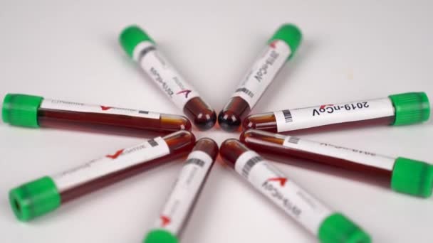 Tubos de ensaio de coronavírus, frascos em laboratório. Coronavírus resultados positivos e negativos do teste . — Vídeo de Stock