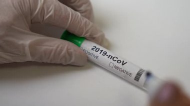 Bir doktor kovid 19 test tüplerini imzalıyor. Bir covid-19 virüs algılama operasyonu