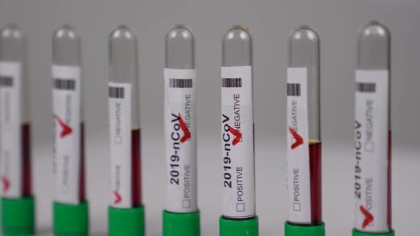 Koronavirové zkumavky, baňky v laboratoři. Koronavirus pozitivní a negativní výsledky testů. — Stock video