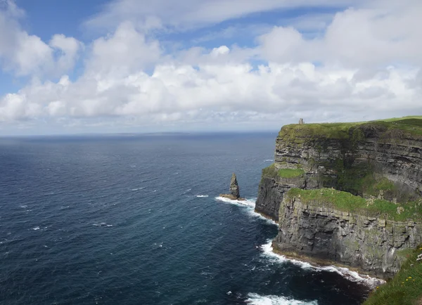 Anne kayalıkları, İrlanda