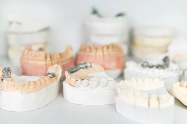 Cast of teeth from gypsum