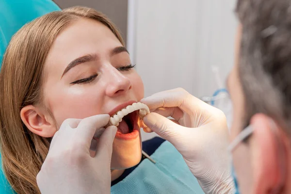 El médico se prueba una prótesis dental — Foto de Stock