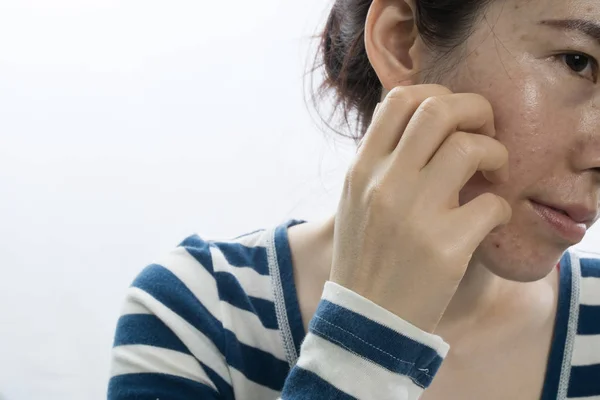 Asian young woman scratching face on isolated white background — Stock Photo, Image