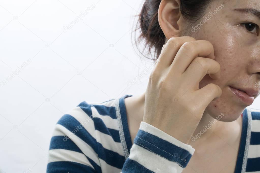 asian young woman scratching face on isolated white background