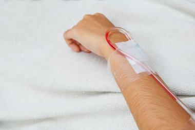 Hasta kemoterapi için intravenöz Başlarken 