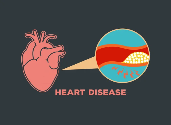 Simbolo icona vettoriale logo malattia cardiaca — Vettoriale Stock