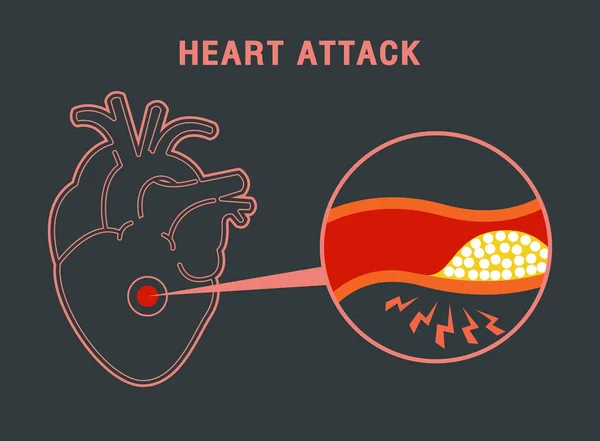 Kalp krizi logo vektör simgesi tasarım — Stok Vektör