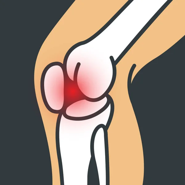 Knee Pain vector logo icon illustrator — Stock Vector