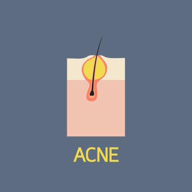 Akne vektör simge tasarlamak