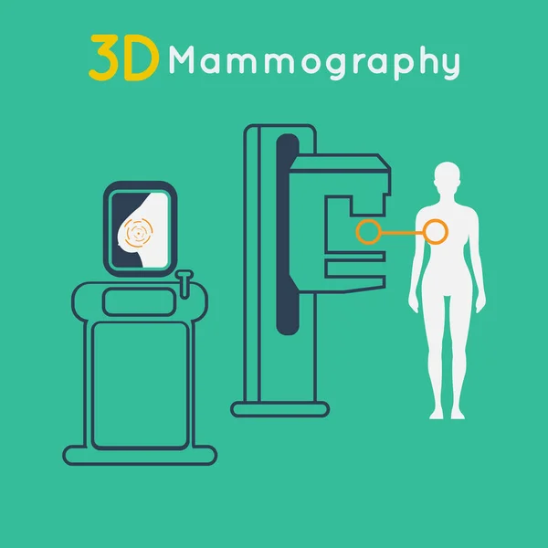 乳がん、3 d マンモグラフィ ベクトル イラスト — ストックベクタ