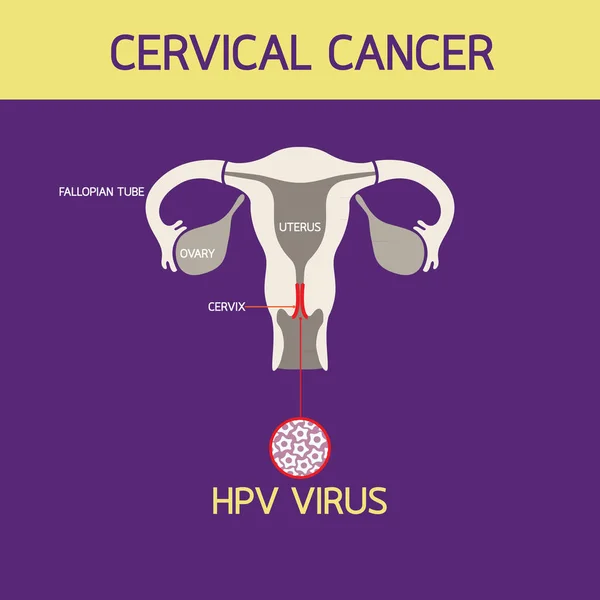 Icono del cáncer cervical Logo vector ilustración — Vector de stock