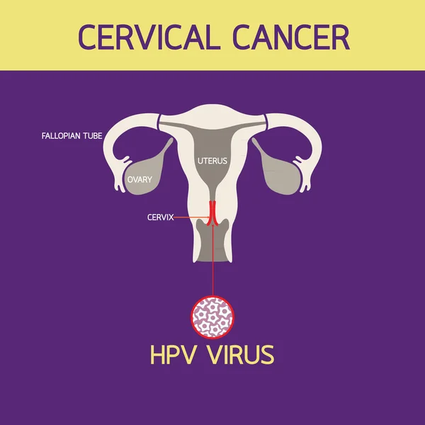 Cervical cancer icon Logo vector illustration — Stock Vector