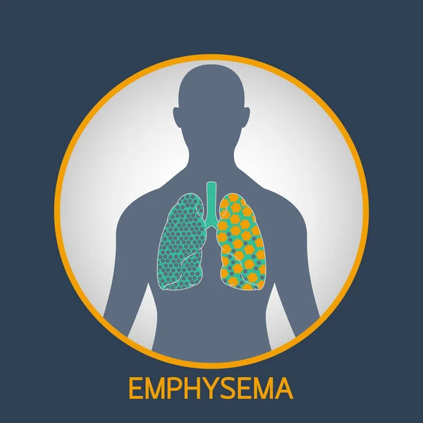 Ilustración del icono del logotipo del vector EMPHYSEMA — Vector de stock