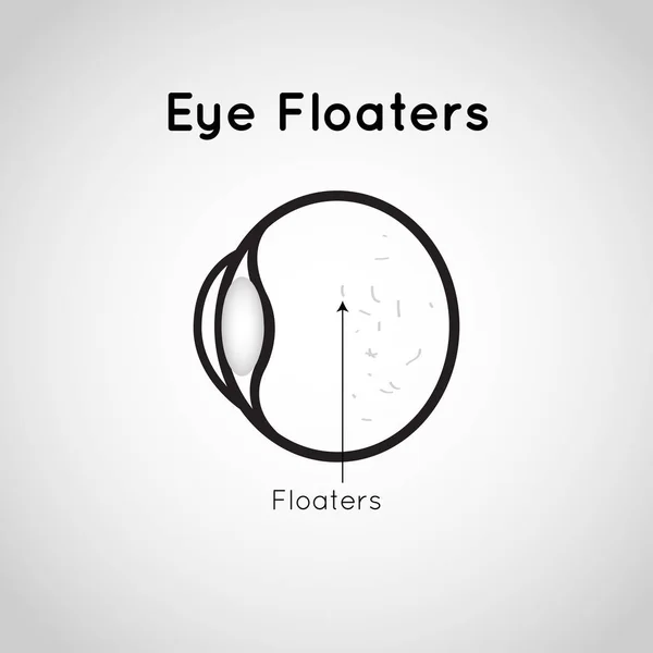 Göz Floaters logo vektör simge tasarlamak