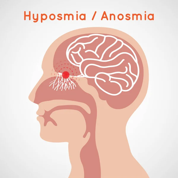 Illustration de conception d'icône vectorielle de logo Hyposmie et Anosmie — Image vectorielle