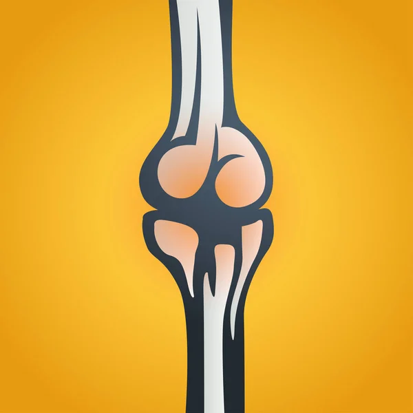 JOINT PAIN vector icono ilustración — Archivo Imágenes Vectoriales