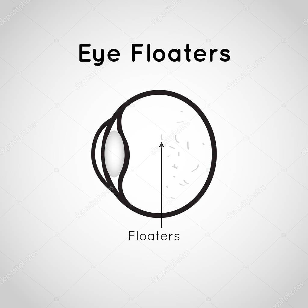 Eye Floaters logo vector icon design illustration