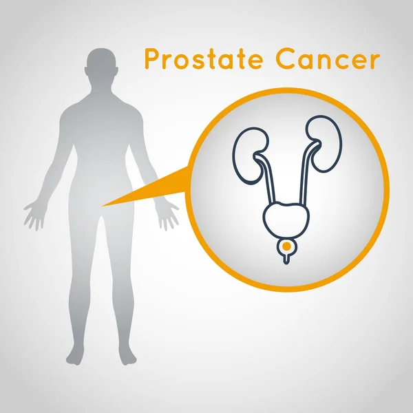 Prostate Cancer vector logo icon illustration — Stock Vector