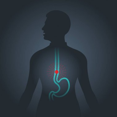 Esophageal Cancer vector logo icon illustration clipart