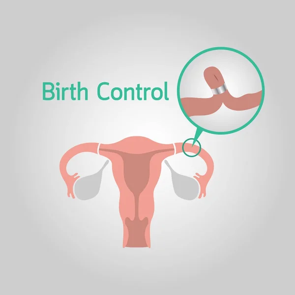 Geboortebeperking vector logo pictogram illustratie — Stockvector