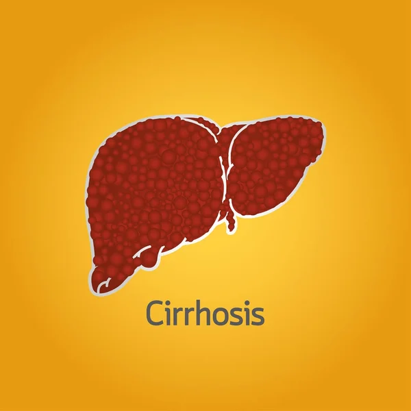 Cirrhosis vector logo icon illustration — Stock Vector