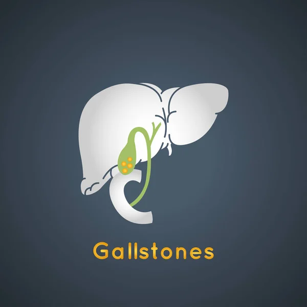 Gallstone vector logo icon illustration — Stock Vector