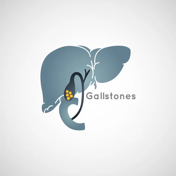 Gallstone vector logo icon illustration — Stock Vector