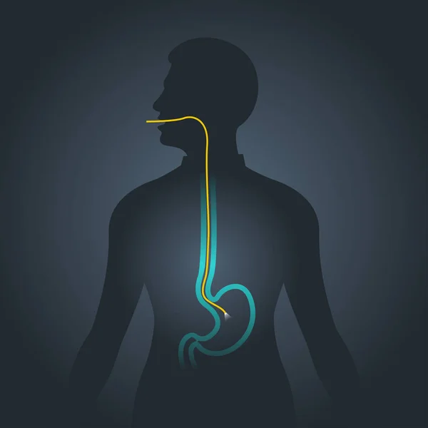 Gastroscopy vector logo pictogram illustratie — Stockvector