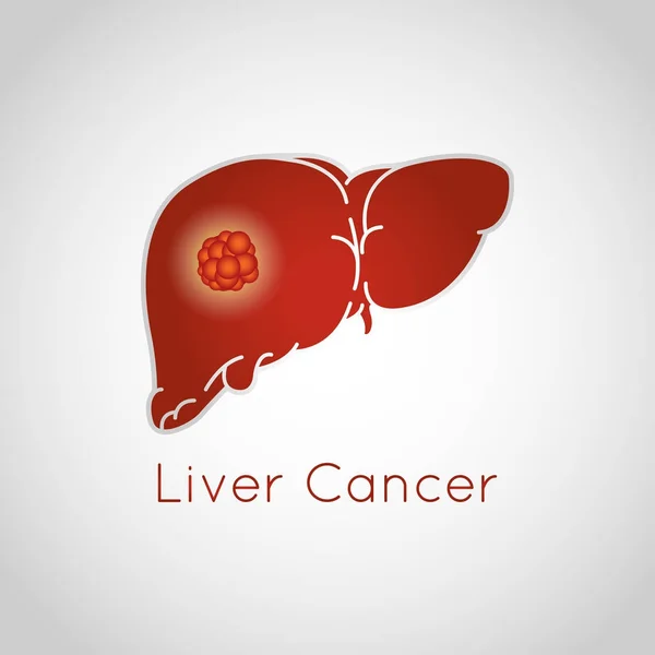 Lever kanker vector logo pictogram illustratie — Stockvector
