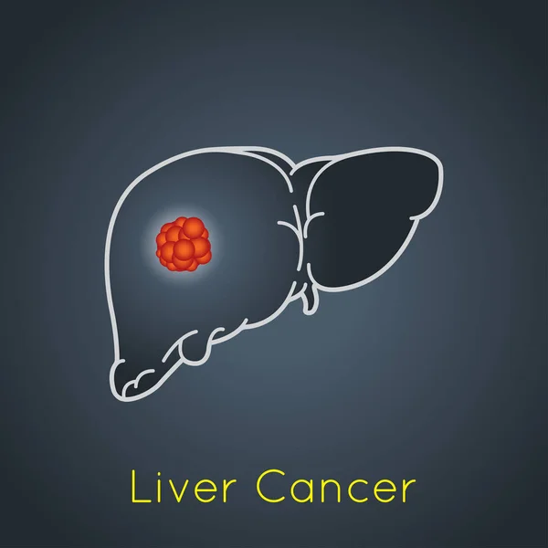 Lever kanker vector logo pictogram illustratie — Stockvector