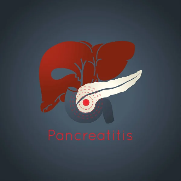 Pancreatitis vector logo pictogram illustratie — Stockvector