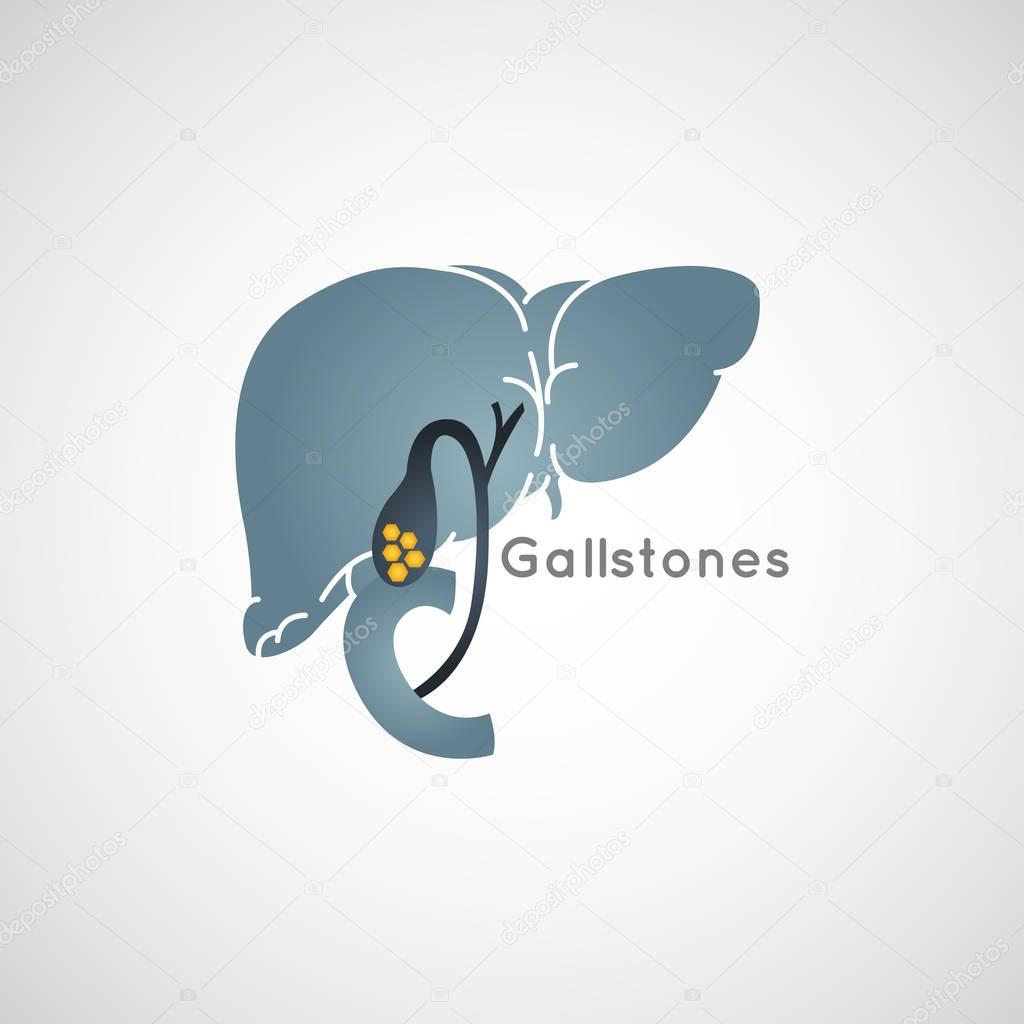 Gallstone vector logo icon illustration