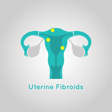 Uterine Fibroids logo vector icon design illustration clipart