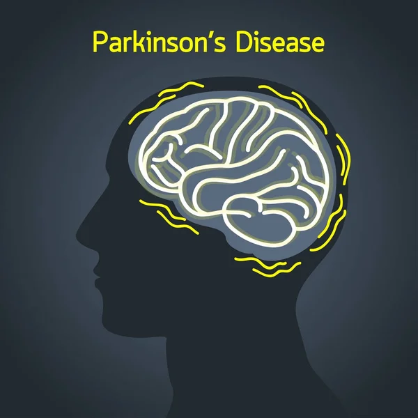 Parkinson ziekte vector logo pictogram — Stockvector