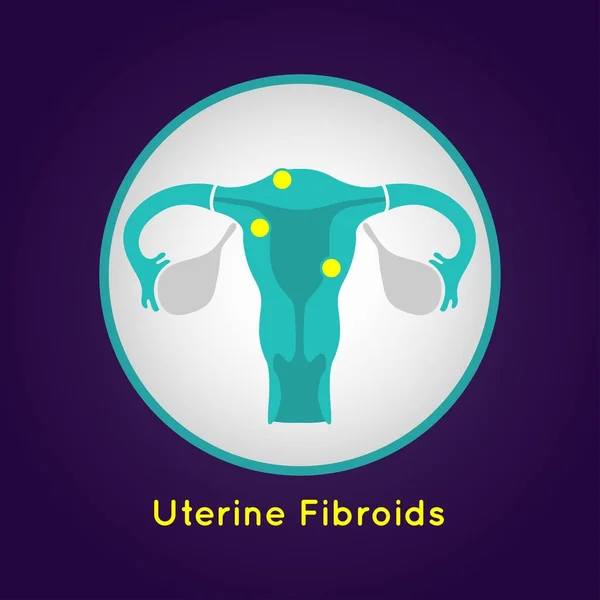 Uterine Fibroids logo vector icon design illustration — Stock Vector