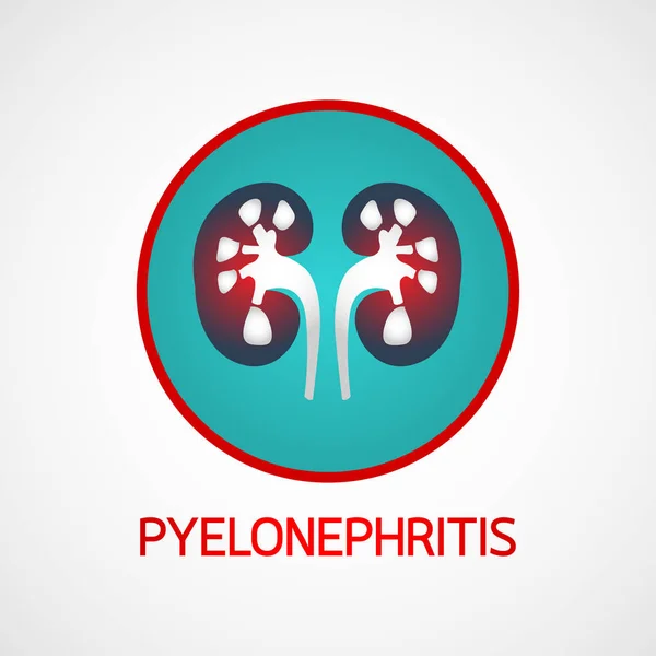 Pyelonefritis vector logo pictogram illustratie — Stockvector