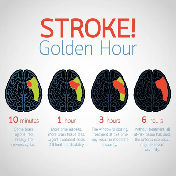 Εγκεφαλικό επεισόδιο εικονογράφηση εικόνα λογότυπο φορέα infographic χρυσή ώρα — Διανυσματικό Αρχείο