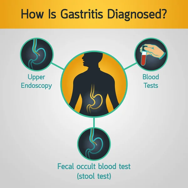 Гастрит Векторна ілюстрація піктограми логотипу — стоковий вектор