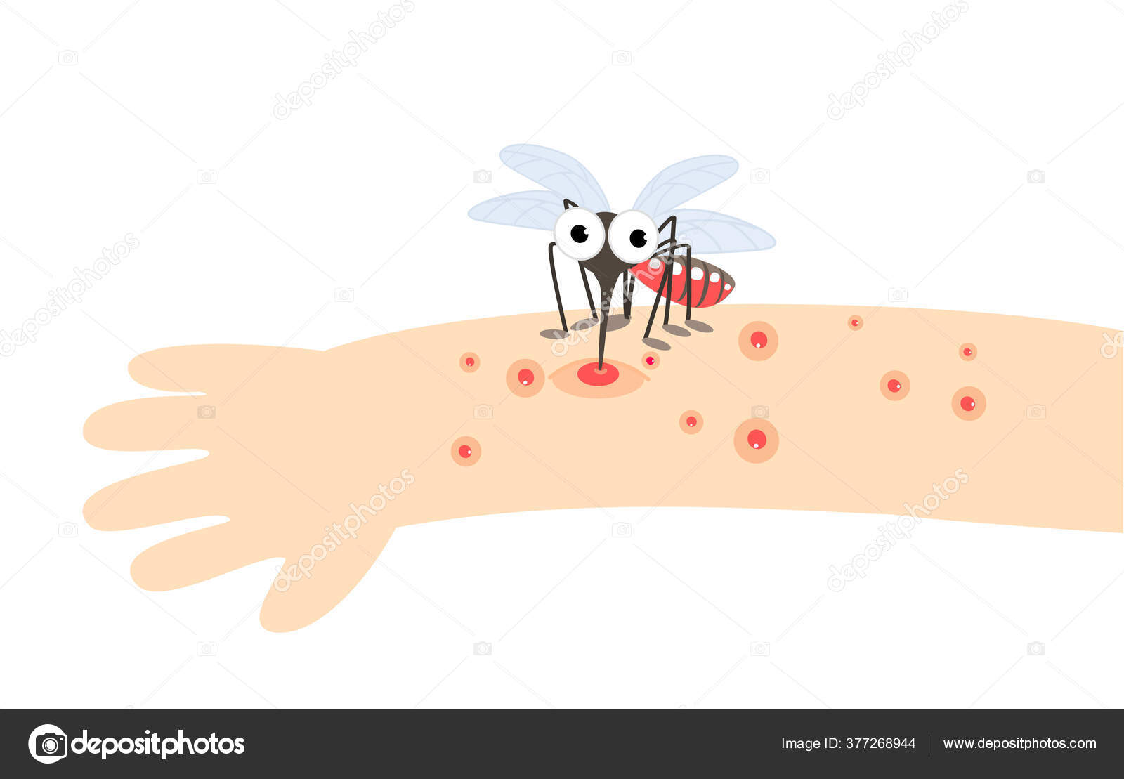 Mosquito Bite Hand Vector Stock Vector Image by ©Promartandcrafts #377268944