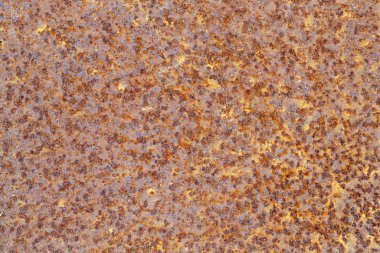 Eskimiş Paslı Metal Doku