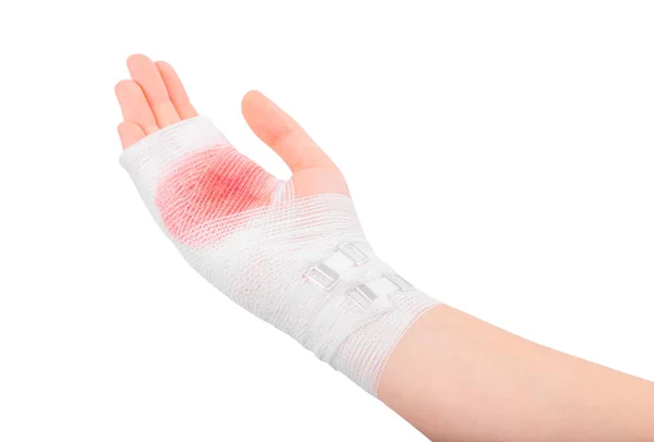 Zraniona ręka dziewczyny związana białym bandażem — Zdjęcie stockowe